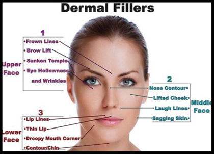 Facial Filler Injections – MSPRS